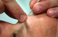 Acupunctura ajuda a combater disfunção eréctil, diz especialista português