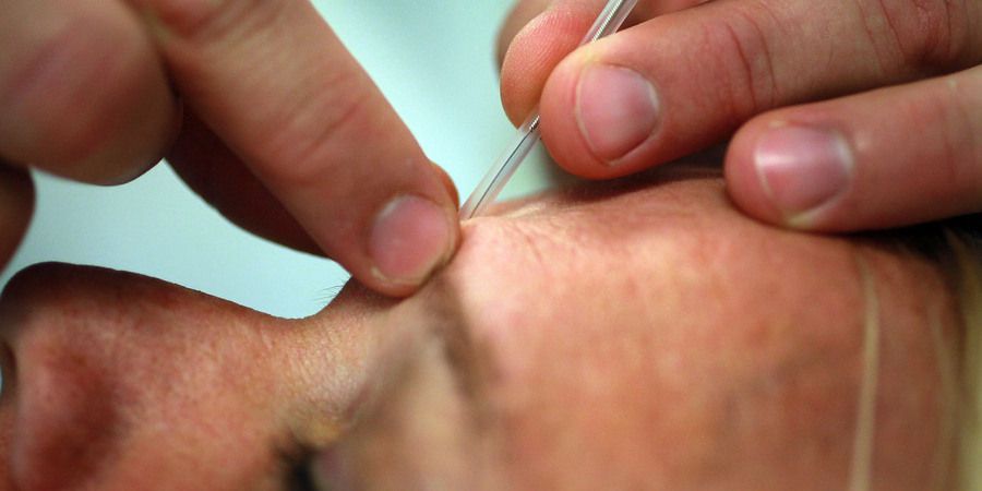 Acupunctura ajuda a combater disfunção eréctil, diz especialista português