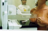 2900 mulheres de Amares estão a ser convidadas a fazer mamografia