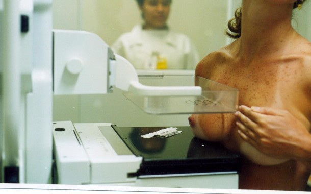 2900 mulheres de Amares estão a ser convidadas a fazer mamografia