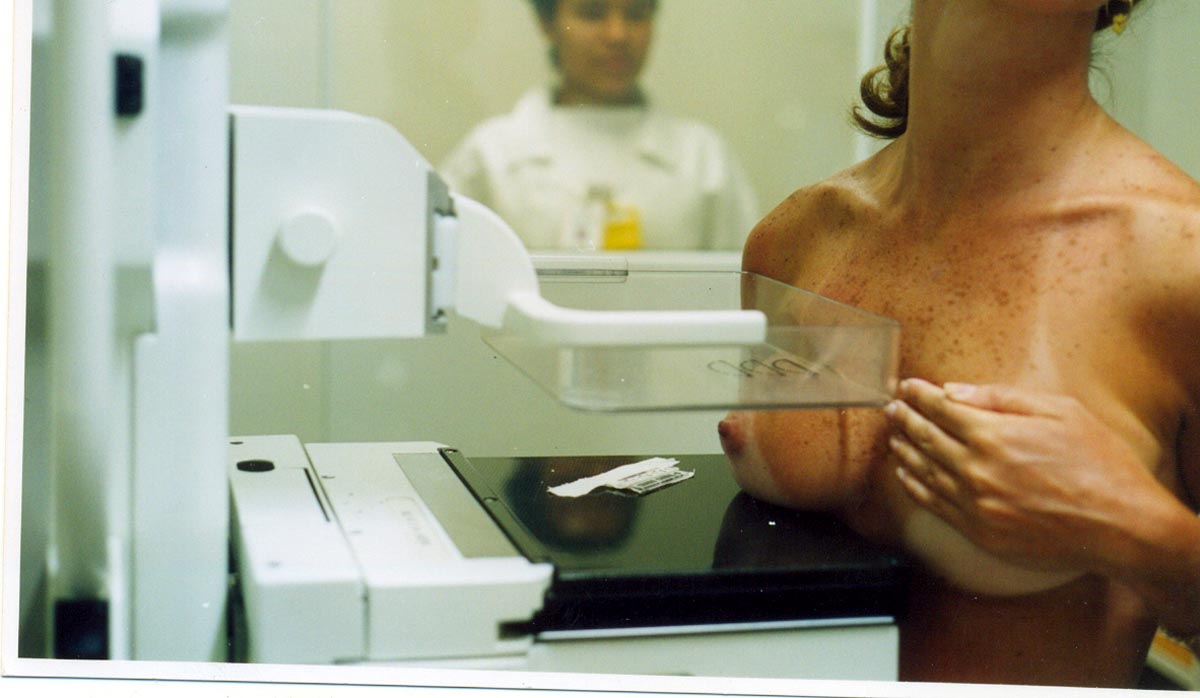 2900 mulheres de Amares estão a ser convidadas a fazer mamografia