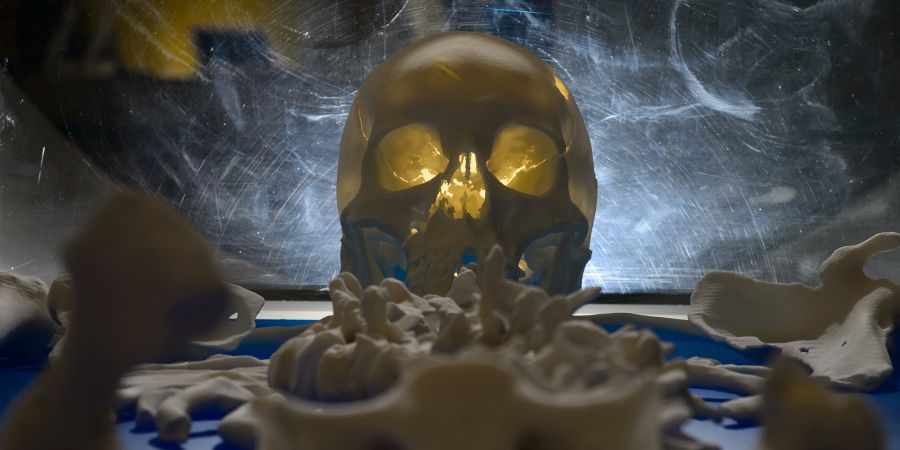Investigadores descobrem cancro mais antigo da história