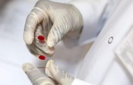 Investigadores do Porto criam novo método para proteger mulheres do VIH