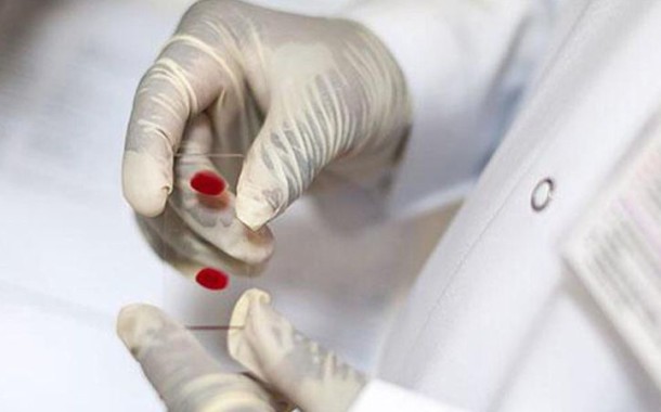 Investigadores do Porto criam novo método para proteger mulheres do VIH
