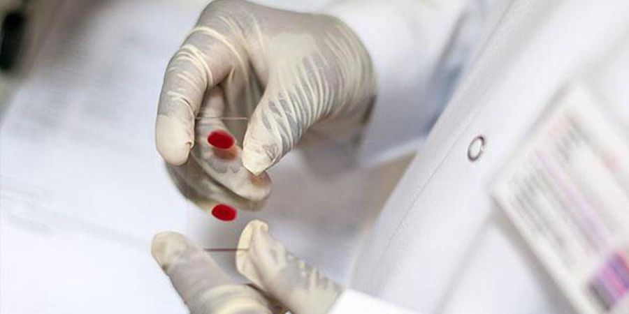 Investigadores do Porto criam novo método para proteger mulheres do VIH