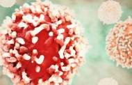 Células da leucemia resistem à quimioterapia porque são “rápidas” e “fogem” dentro da medula
