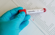 Qualidade do ar mais fiscalizada para evitar surtos de legionella