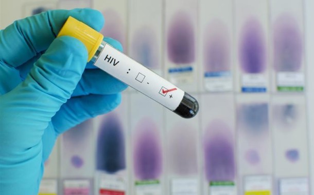 Teste ao HIV e Hepatice C poderá ser feito em casa