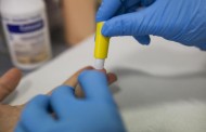 Já é possível fazer testes ao VIH/sida e hepatites nas farmácias