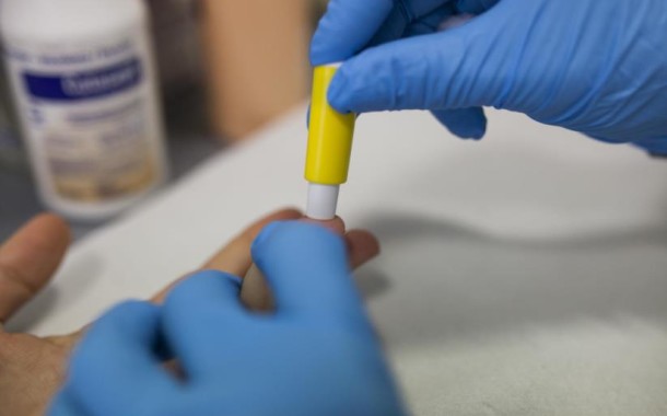 Já é possível fazer testes ao VIH/sida e hepatites nas farmácias