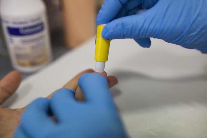 Já é possível fazer testes ao VIH/sida e hepatites nas farmácias