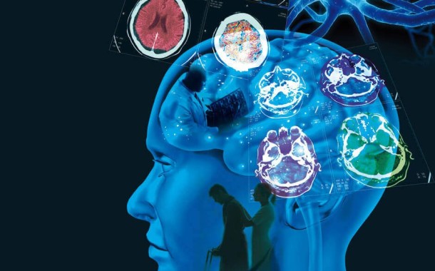 UMinho demostra que olhos revelam alterações cognitivas nos doentes de esclerose múltipla