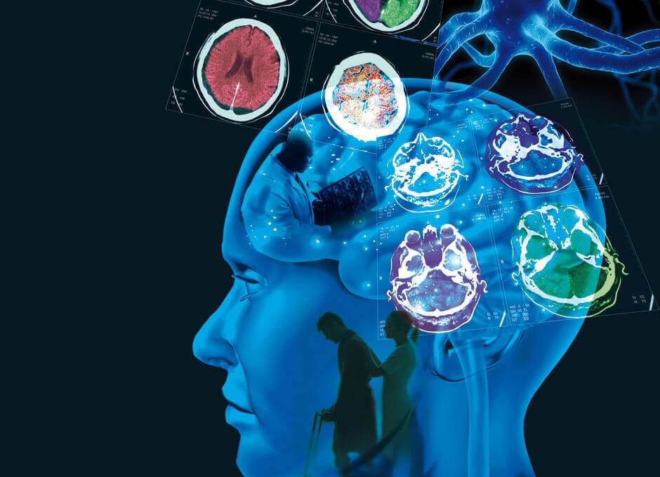 UMinho demostra que olhos revelam alterações cognitivas nos doentes de esclerose múltipla