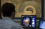 Descoberta possível sintoma inicial da doença de Alzheimer