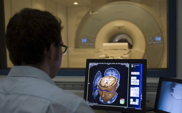 Descoberta possível sintoma inicial da doença de Alzheimer