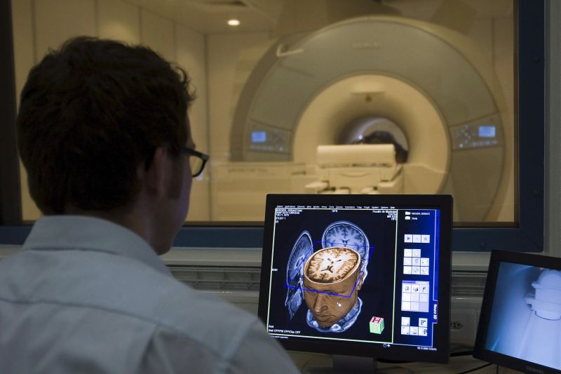 Descoberta possível sintoma inicial da doença de Alzheimer