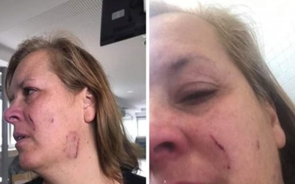 Pastor Alemão ataca mulher e mata cão em Braga