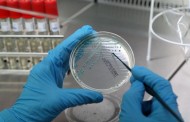Bactéria ‘E. coli’ detectada em suplemento alimentar de canábis à venda em farmácias