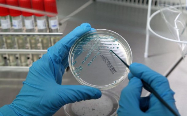Bactéria ‘E. coli’ detectada em suplemento alimentar de canábis à venda em farmácias