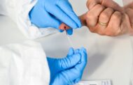 Testes para estimar incidência da covid-19 na população já arrancaram