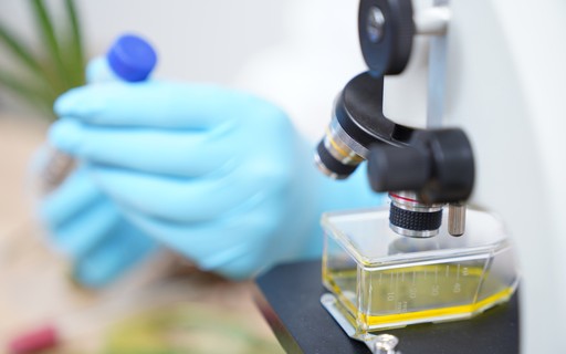 Norte soma mais 71 casos de covid-19 em 24 horas. País com 259 novas infecções e quatro mortes