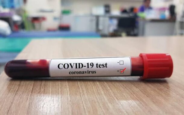 Pais souberam que dois filhos estavam infectadas de covid-19 pela comunicação social. “Inaceitável!”, dizem