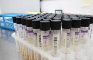 Bloco questiona Governo sobre falta de resposta à realização de testes no Laboratório de Saúde Pública de Braga