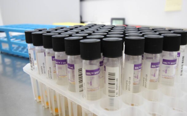 Bloco questiona Governo sobre falta de resposta à realização de testes no Laboratório de Saúde Pública de Braga
