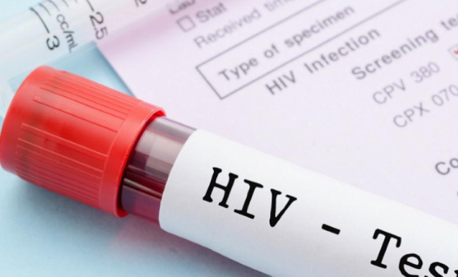 Barcelos e Braga promovem rastreio HIV e hepatites até dia 27 (c/vídeo)
