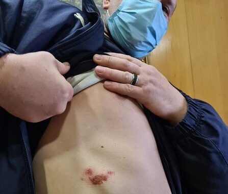 Imigrante ucraniano, que acusa PSP de Vila do Conde de agressão começou a ser julgado por excesso de álcool