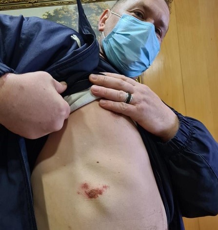 Imigrante ucraniano, que acusa PSP de Vila do Conde de agressão começou a ser julgado por excesso de álcool