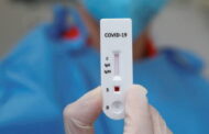 Governo autoriza venda de testes rápidos à covid-19 em farmácias