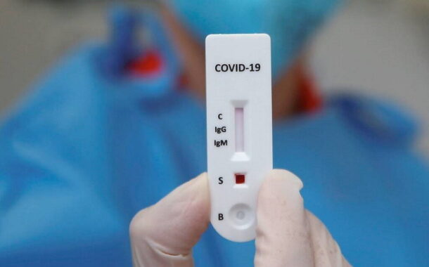 Governo autoriza venda de testes rápidos à covid-19 em farmácias