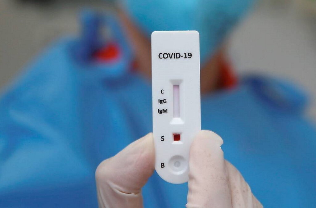 Governo autoriza venda de testes rápidos à covid-19 em farmácias