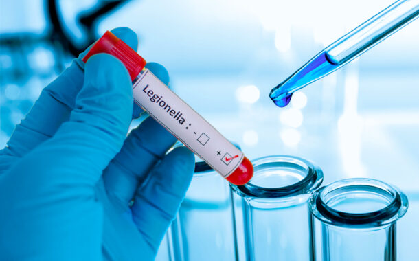 Sobe para sete o número de pessoas com “legionella” em Caminha