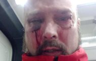 Socorrista da Cruz Vermelha “brutalmente agredido” durante socorro na Maia