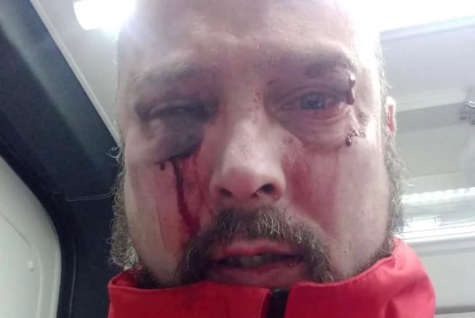 Socorrista da Cruz Vermelha “brutalmente agredido” durante socorro na Maia