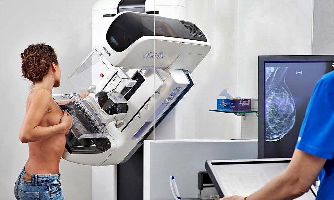 Mulheres com 45 anos convocadas para mamografia conforme itinerário das carrinhas de rastreio