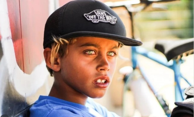 Cancro mata jovem promessa do surf português aos 12 anos